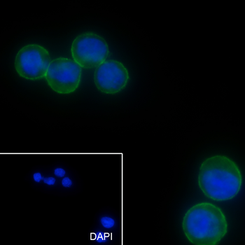 CD321 Recombinant Mouse Monoclonal Antibody