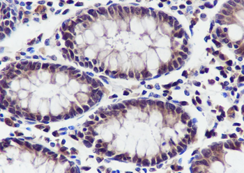 NUP50 Recombinant Mouse Monoclonal Antibody