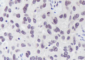 NUP50 Recombinant Mouse Monoclonal Antibody