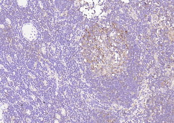 CD25 Recombinant Rabbit Monoclonal Antibody