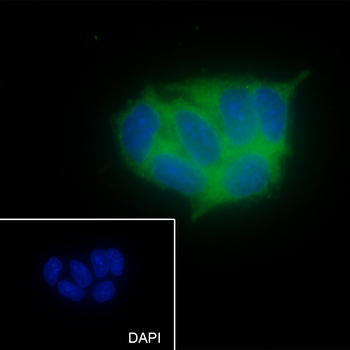 ERO1L Recombinant Mouse Monoclonal Antibody