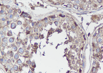 BCAR1 Recombinant Mouse Monoclonal Antibody