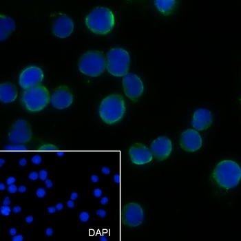 CD89 Recombinant Mouse Monoclonal Antibody