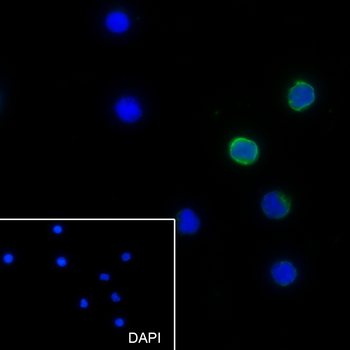 CD5 Recombinant Mouse Monoclonal Antibody