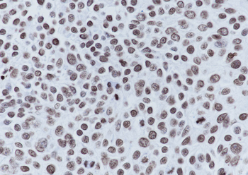 Acetyl-Histone H4 (Lys16) Recombinant Mouse Monoclonal Antibody