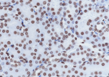 Acetyl-Histone H4 (Lys16) Recombinant Mouse Monoclonal Antibody