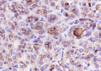 TG Recombinant Rabbit Monoclonal Antibody