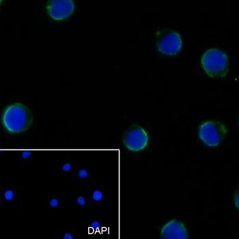 CD43 Recombinant Mouse Monoclonal Antibody