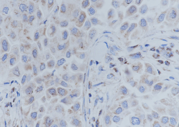 ATPB Recombinant Mouse Monoclonal Antibody