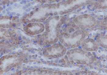 ATPB Recombinant Mouse Monoclonal Antibody