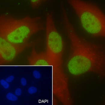 Mono-Methyl-Histone H4 (Lys20) Recombinant Mouse Monoclonal Antibody