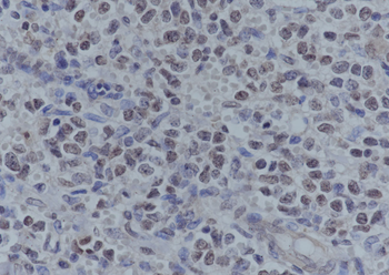 Acetyl-Histone H3 (Lys4) Recombinant Rabbit Monoclonal Antibody