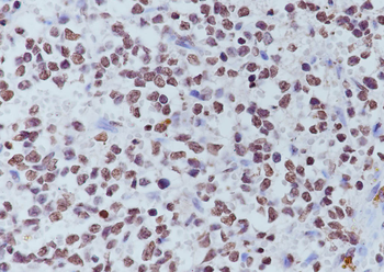 Tri-Methyl-Histone H3 (Lys27) Recombinant Mouse Monoclonal Antibody