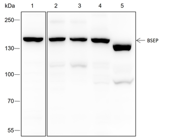 ABCB11 Recombinant Rabbit Monoclonal Antibody