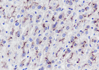 ABCB11 Recombinant Rabbit Monoclonal Antibody