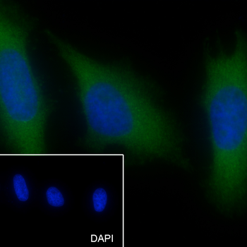 PLCB3 Recombinant Mouse Monoclonal Antibody