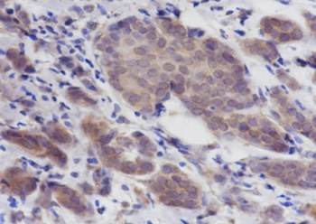 PLCB3 Recombinant Mouse Monoclonal Antibody