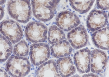 PLCB3 Recombinant Mouse Monoclonal Antibody