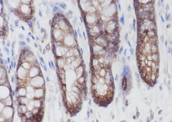 PLCB3 Recombinant Mouse Monoclonal Antibody