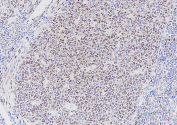 LMO2 Recombinant Rabbit Monoclonal Antibody
