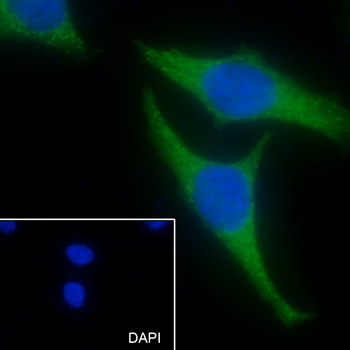 Paxillin Recombinant Rabbit Monoclonal Antibody