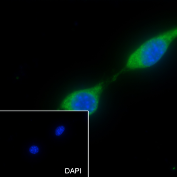 Paxillin Recombinant Rabbit Monoclonal Antibody