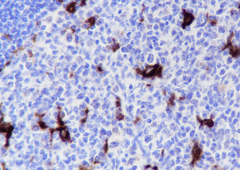 GPNMB Recombinant Rabbit Monoclonal Antibody