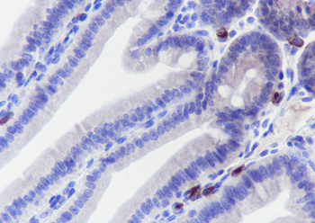 GPNMB Recombinant Rabbit Monoclonal Antibody