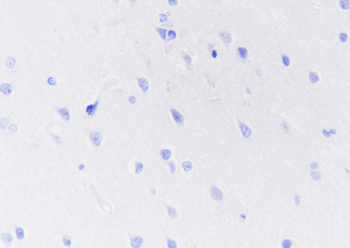 DPEP1 Recombinant Rabbit Monoclonal Antibody