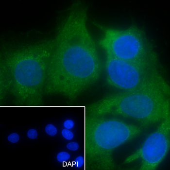SMYD2 Recombinant Mouse Monoclonal Antibody