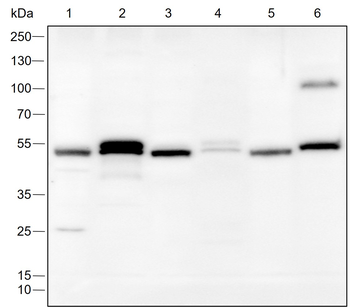 FLI1 Recombinant Rabbit Monoclonal Antibody