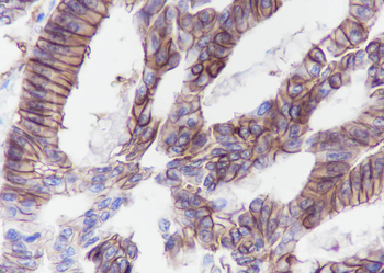 CDH17/LI-cadherin Recombinant Rabbit Monoclonal Antibody