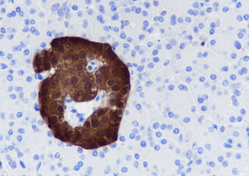 SCGN Recombinant Rabbit Monoclonal Antibody