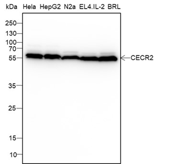 CECR2 Recombinant Mouse Monoclonal Antibody