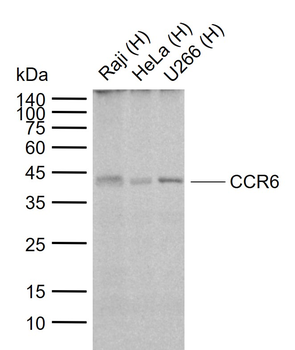 CCR6 Recombinant Rabbit Monoclonal Antibody