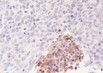 Tenascin X Recombinant Rabbit Monoclonal Antibody