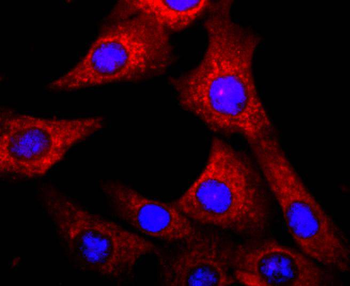 AHR Recombinant Rabbit Monoclonal Antibody