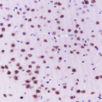 NUDT21 Recombinant Mouse Monoclonal Antibody