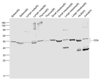 CD4 Rabbit Polyclonal Antibody