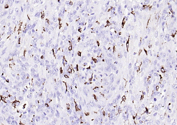CD68 Recombinant Rabbit Monoclonal Antibody
