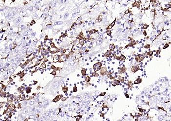 CD68 Recombinant Rabbit Monoclonal Antibody