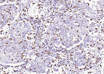 CD68 Recombinant Rabbit Monoclonal Antibody