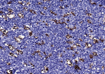 CD68 Recombinant Rabbit Monoclonal Antibody