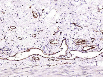 CD31 Recombinant Rabbit Monoclonal Antibody