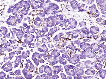 CD31 Recombinant Rabbit Monoclonal Antibody