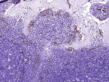 CD31 Recombinant Rabbit Monoclonal Antibody