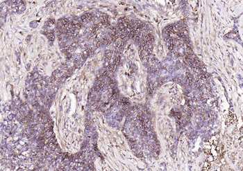 Human CD44 Mouse Monoclonal Antibody