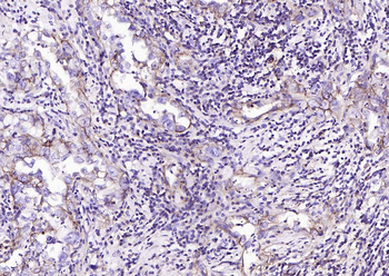 Human CD44 Mouse Monoclonal Antibody