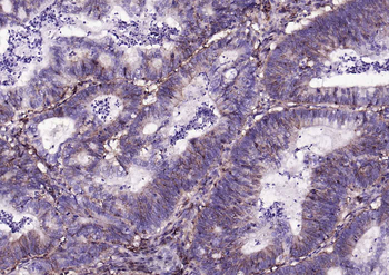 Human CD44 Mouse Monoclonal Antibody