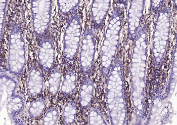 Human CD44 Mouse Monoclonal Antibody